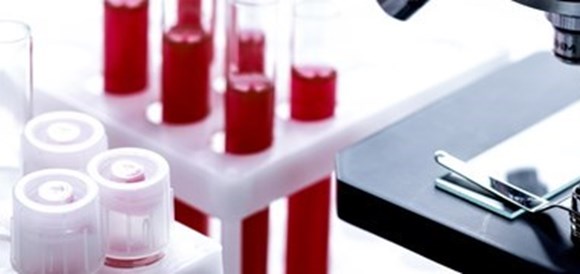 צילום: שאטרסטוק בדיקת CMV Antibodies IgM - תמונה